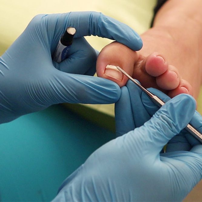Reconstrucción de uñas con Gel